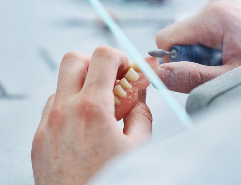 東日本橋・馬喰横山の歯医者、須藤デンタルクリニックの入れ歯治療