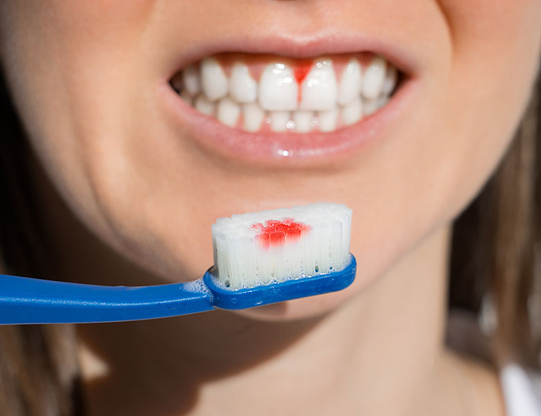 東日本橋・馬喰横山の歯医者、須藤デンタルクリニックの歯周病治療