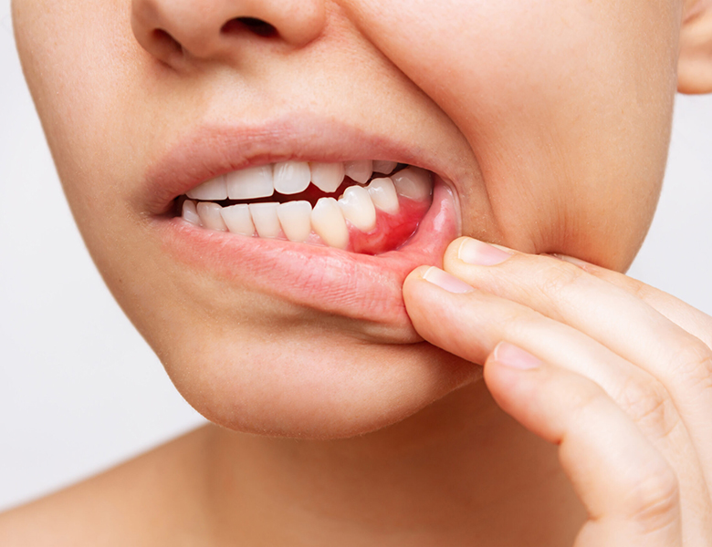 東日本橋・馬喰横山の歯医者、須藤デンタルクリニックのプラセンタ療法