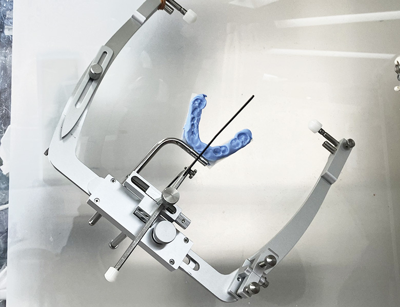 東日本橋・馬喰横山の歯医者、須藤デンタルクリニックの入れ歯治療