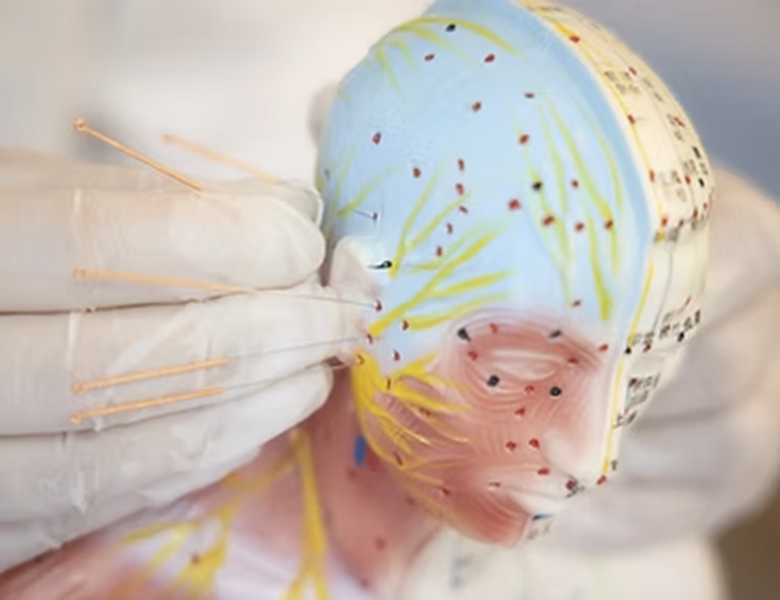 東日本橋・馬喰横山の歯医者、須藤デンタルクリニックの顎関節症・咬み合わせ治療