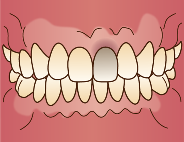 東日本橋・馬喰横山の歯医者、須藤デンタルクリニックのホワイトニング