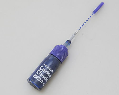 東日本橋・馬喰横山の歯医者、須藤デンタルクリニックのむし歯治療