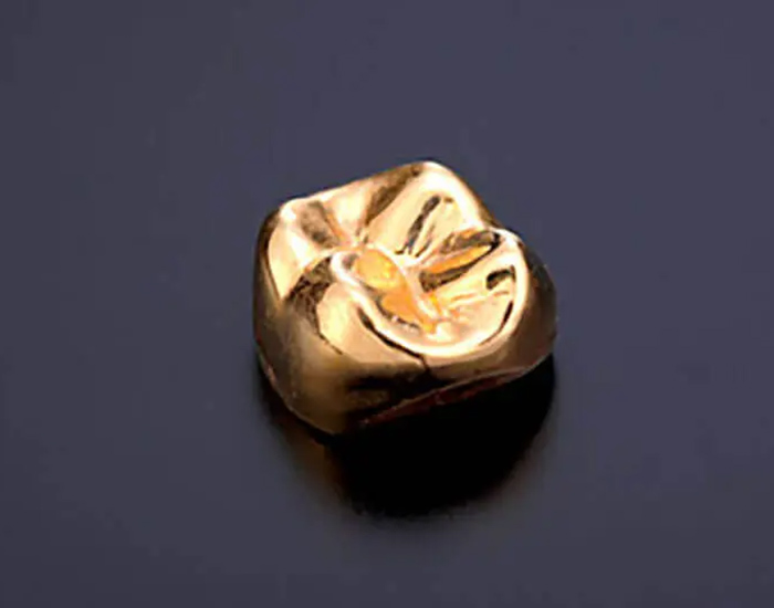 東日本橋・馬喰横山の歯医者、須藤デンタルクリニックの審美歯科治療