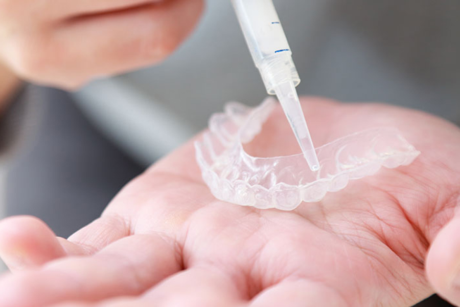 東日本橋・馬喰横山の歯医者、須藤デンタルクリニックのホワイトニング