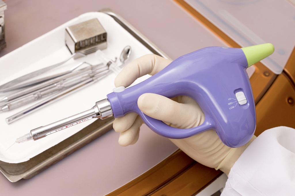 東日本橋・馬喰横山の歯医者、須藤デンタルクリニックのむし歯治療