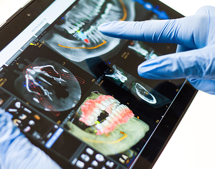 東日本橋・馬喰横山の歯医者、須藤デンタルクリニックのインプラント治療