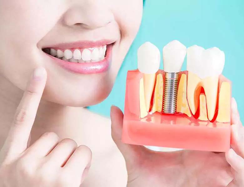 東日本橋・馬喰横山の歯医者、須藤デンタルクリニックのインプラント治療