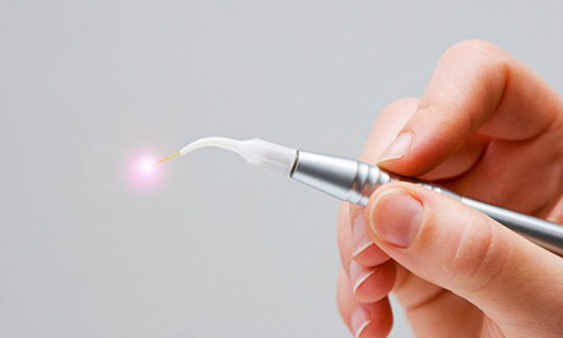 東日本橋・馬喰横山の歯医者、須藤デンタルクリニックの顎関節症・咬み合わせ治療