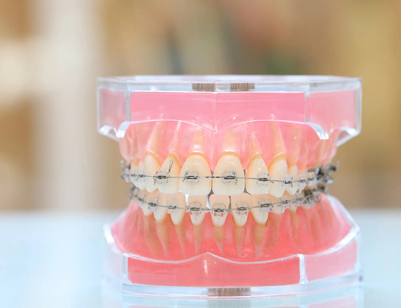 東日本橋・馬喰横山の歯医者、須藤デンタルクリニックの大人の矯正歯科