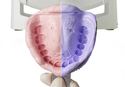 東日本橋・馬喰横山の歯医者、須藤デンタルクリニックの審美歯科治療
