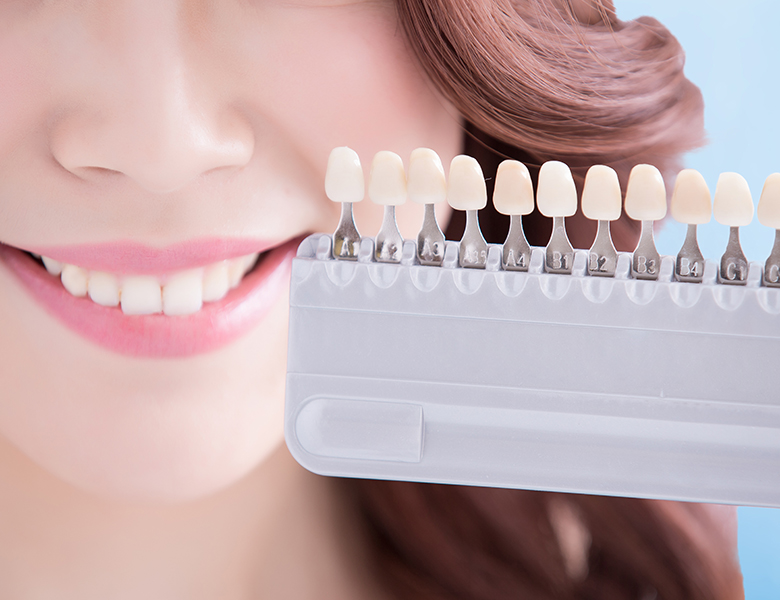 東日本橋・馬喰横山の歯医者、須藤デンタルクリニックのホワイトニング