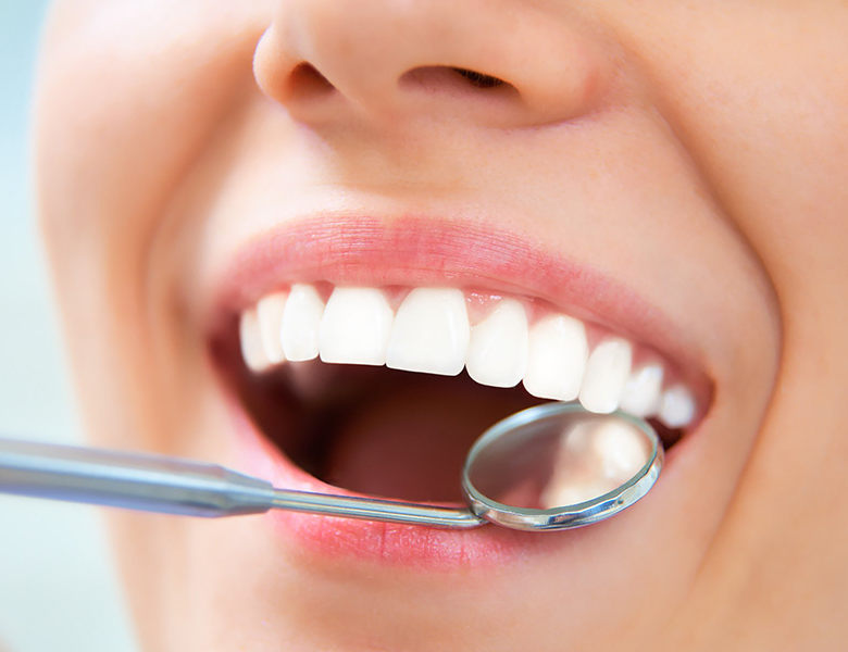 東日本橋・馬喰横山の歯医者、須藤デンタルクリニックの予防歯科