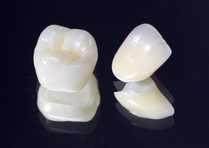 東日本橋・馬喰横山の歯医者、須藤デンタルクリニックの審美歯科治療